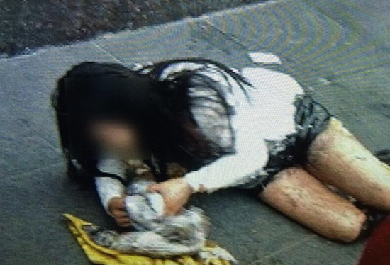 西安一女子当街被泼硫酸