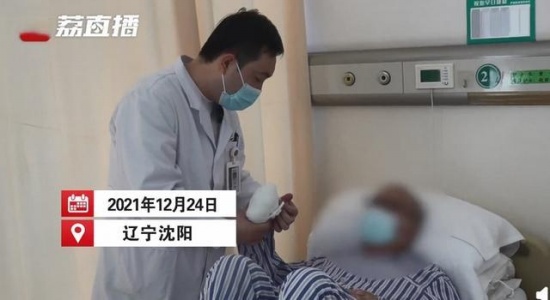 男子冬天醉卧路边冻掉4根手指